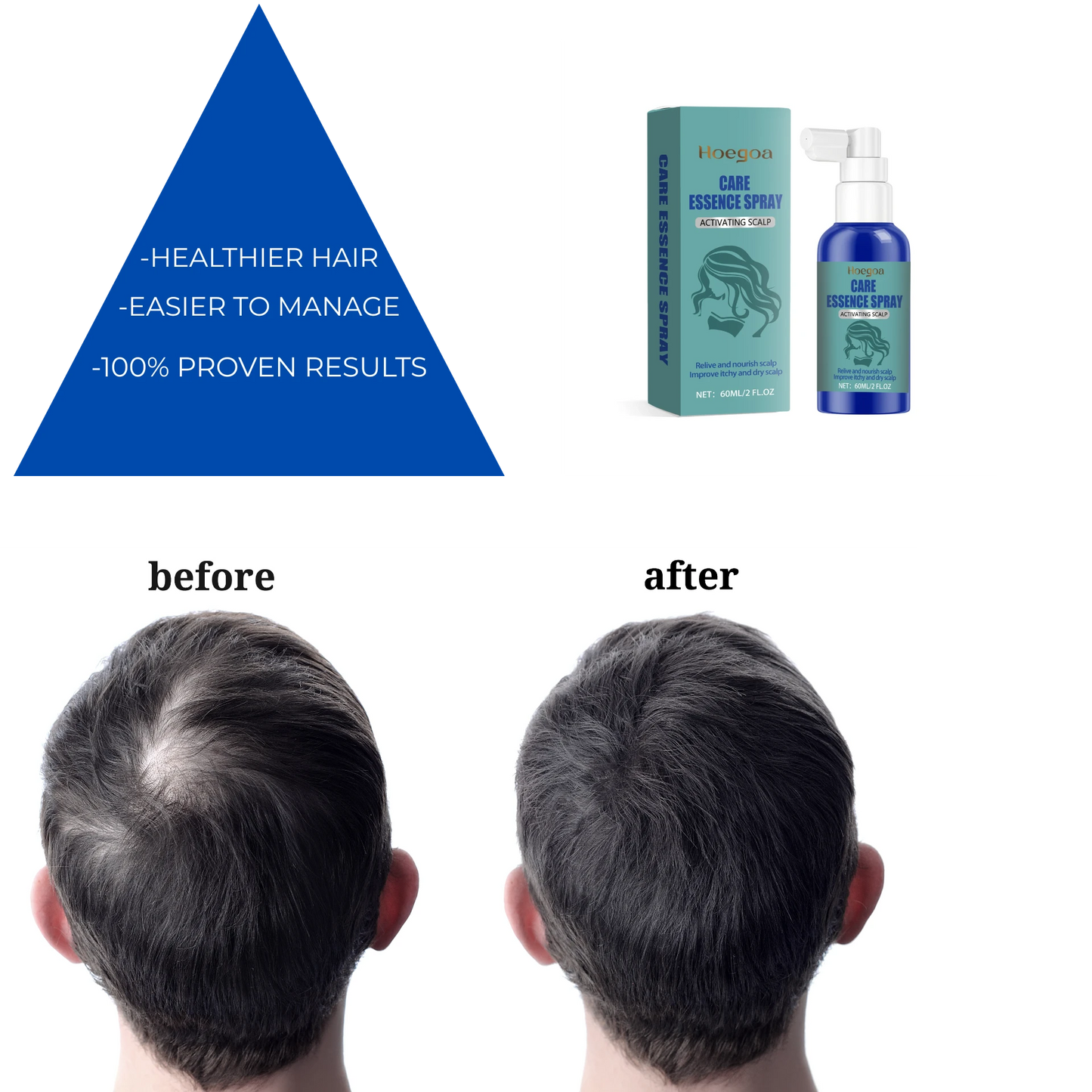 Scalora - Scalp Care Serum